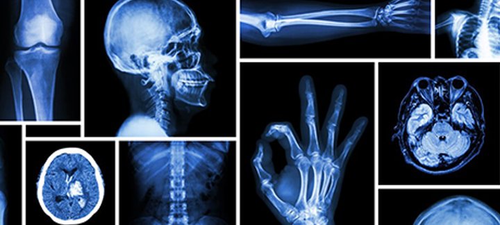 استكشاف عالم الأشعة: جودة التشخيص والرعاية الفائقة - مجموعة درة القاضي الطبية