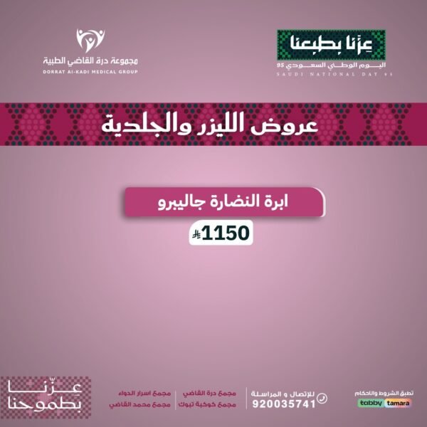ابرة النضارة جاليبو