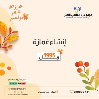 إنشاء غمازة