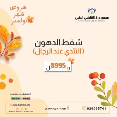 شفط دهون التثدي عند الرجال